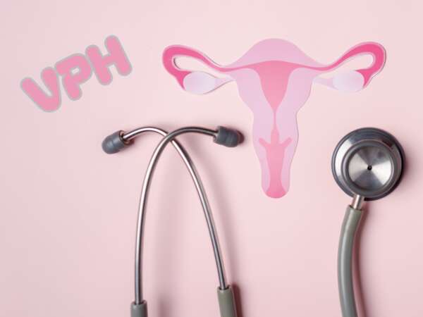 VPH