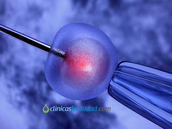 Inseminacion artificial