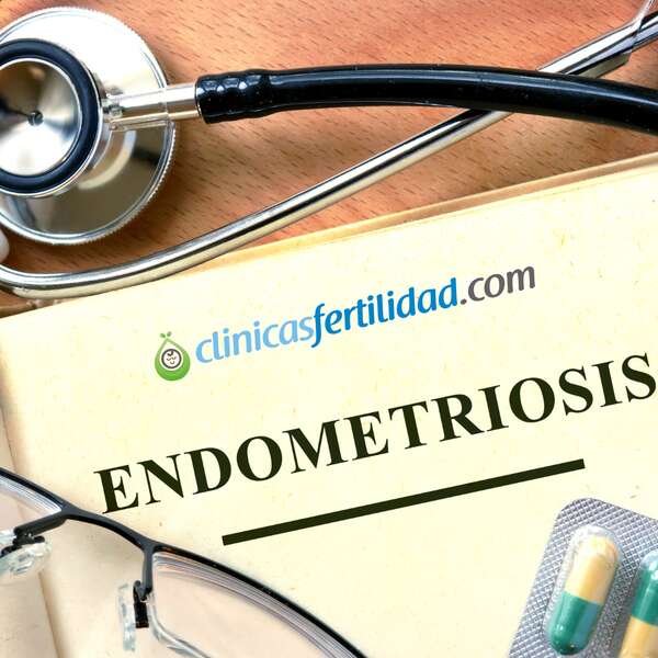 Endometriosis y fertilidad
