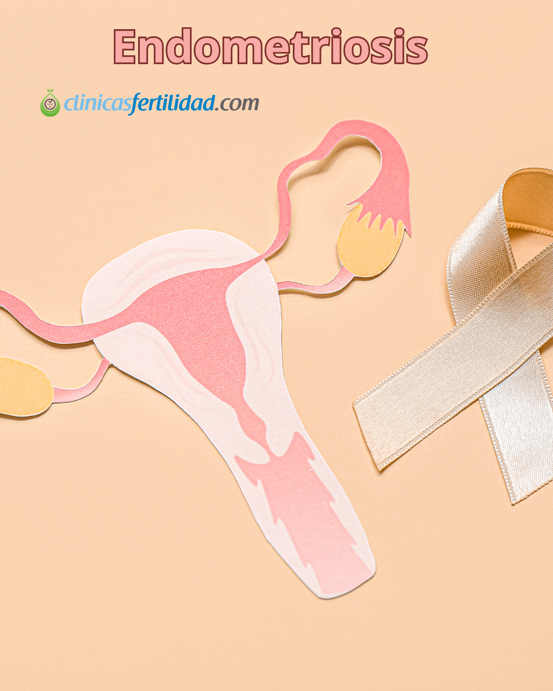 Efecto de la endometriosis en la calidad de los óvulos