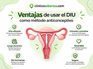 Ventajas de usar el DIU como método anticonceptivo