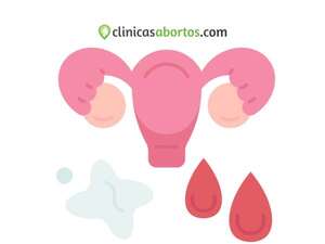 Colores del flujo vaginal