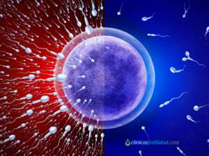 Comprendiendo la Azoospermia: Causas y opciones de tratamiento