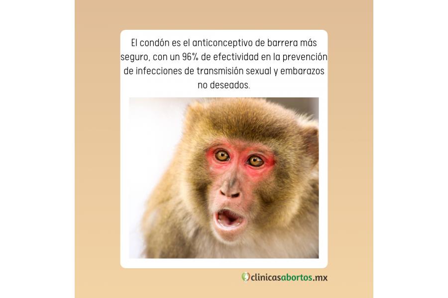 El condón, el anticonceptivo más seguro para prevenir ETS