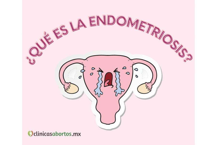 ¿Qué es la endometriosis?