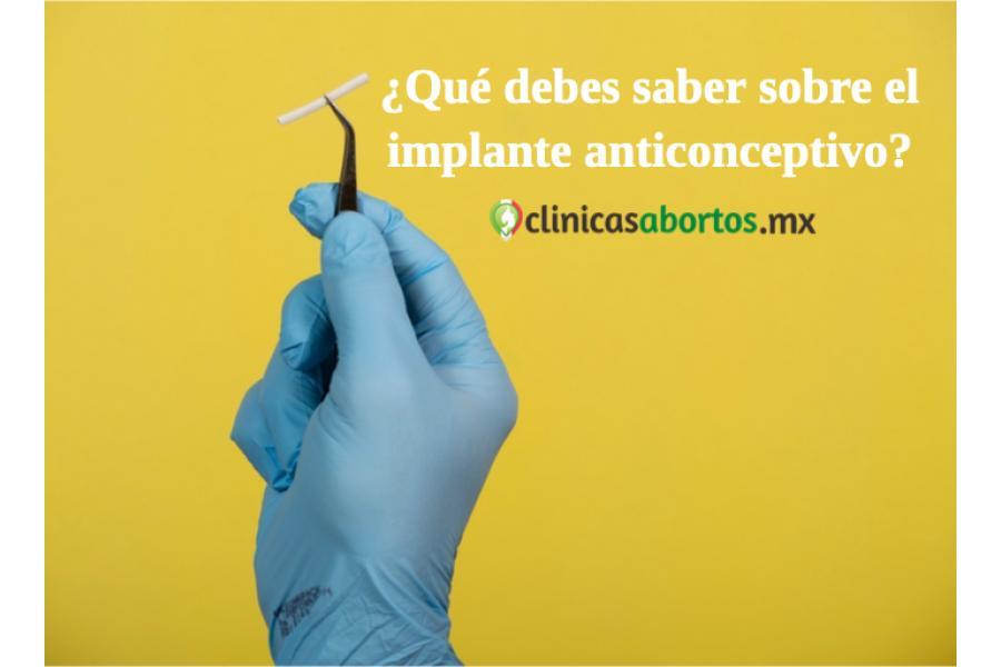 ¿Qué debes saber sobre el implante anticonceptivo?