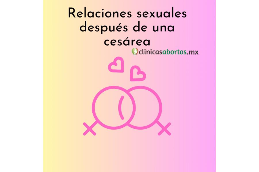 Relaciones sexuales después de una cesárea