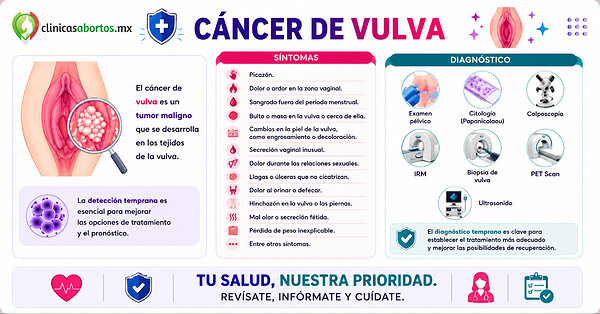 010578a9c51048529ce63bccc0c39e9a cancer de vulva