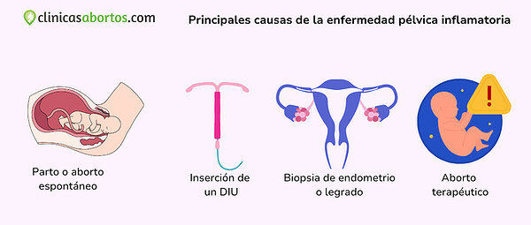 9dc98316b2ff4a759f33dee50203aa96 principales causas de la enfermedad pelvica inflamatoria