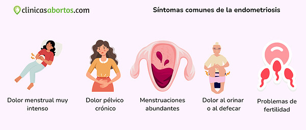 dc708e977c8f4e14a42721b30803343d sintomas comunes de la endometriosis