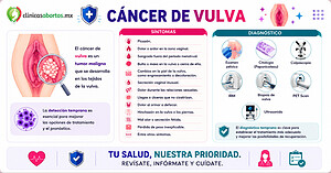 Información sobre el cáncer de vulva