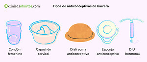 Tipos de anticonceptivos de barrera