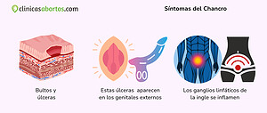 Síntomas del Chancro