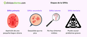 Etapas de la sífilis
