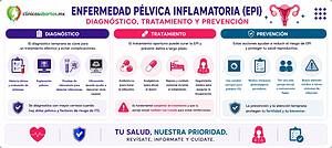 Diagnóstico, tratamiento y prevención de la enfermedad pélvica inflamatoria