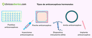 Tipos de anticonceptivos hormonales