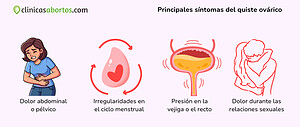 Principales síntomas del quiste ovárico