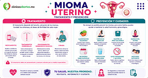Tratamiento y prevención del mioma uterino