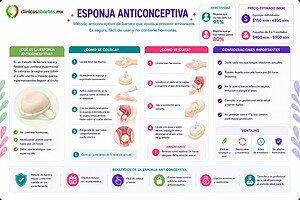Todo lo que debes saber sobre la esponja anticonceptiva