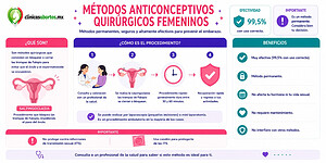 Toda la información sobre los métodos anticonceptivos quirúrgicos