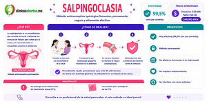 Toda la información sobre la salpingoclasia