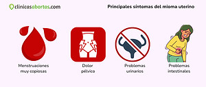 Principales síntomas del mioma uterino