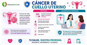 Información sobre el cáncer de cuello de útero