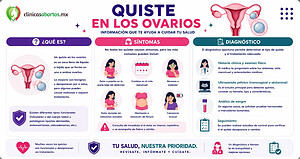 Síntomas y diagnóstico de los quistes en los ovarios
