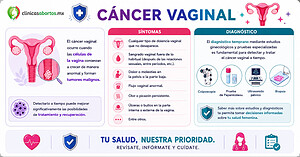 Información sobre el cáncer vaginal