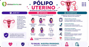 Síntomas y diagnóstico de los pólipos uterinos