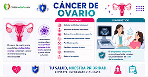 Información sobre el cáncer de ovario