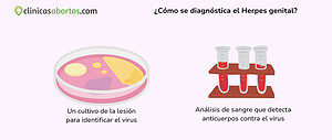 ¿Cómo se diagnóstica el Herpes genital?