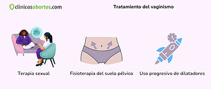 Tratamiento del vaginismo