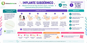 Todo lo que necesitas saber sobre el implante anticonceptivo