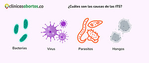 ¿Cuáles son las causas de las ITS?