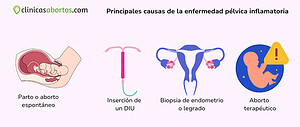 Principales causas de la enfermedad pélvica inflamatoria