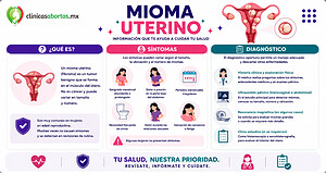 Síntomas y diagnóstico del mioma uterino