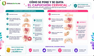 Todo lo que debes saber sobre el capuchón cervical