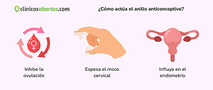 Cómo funciona el anillo anticonceptivo