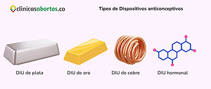 Tipos de Dispositivos anticonceptivos