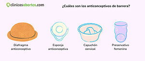 ¿Cuáles son los anticonceptivos de barrera?