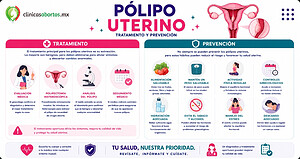 Tratamiento y prevención de los pólipos uterinos