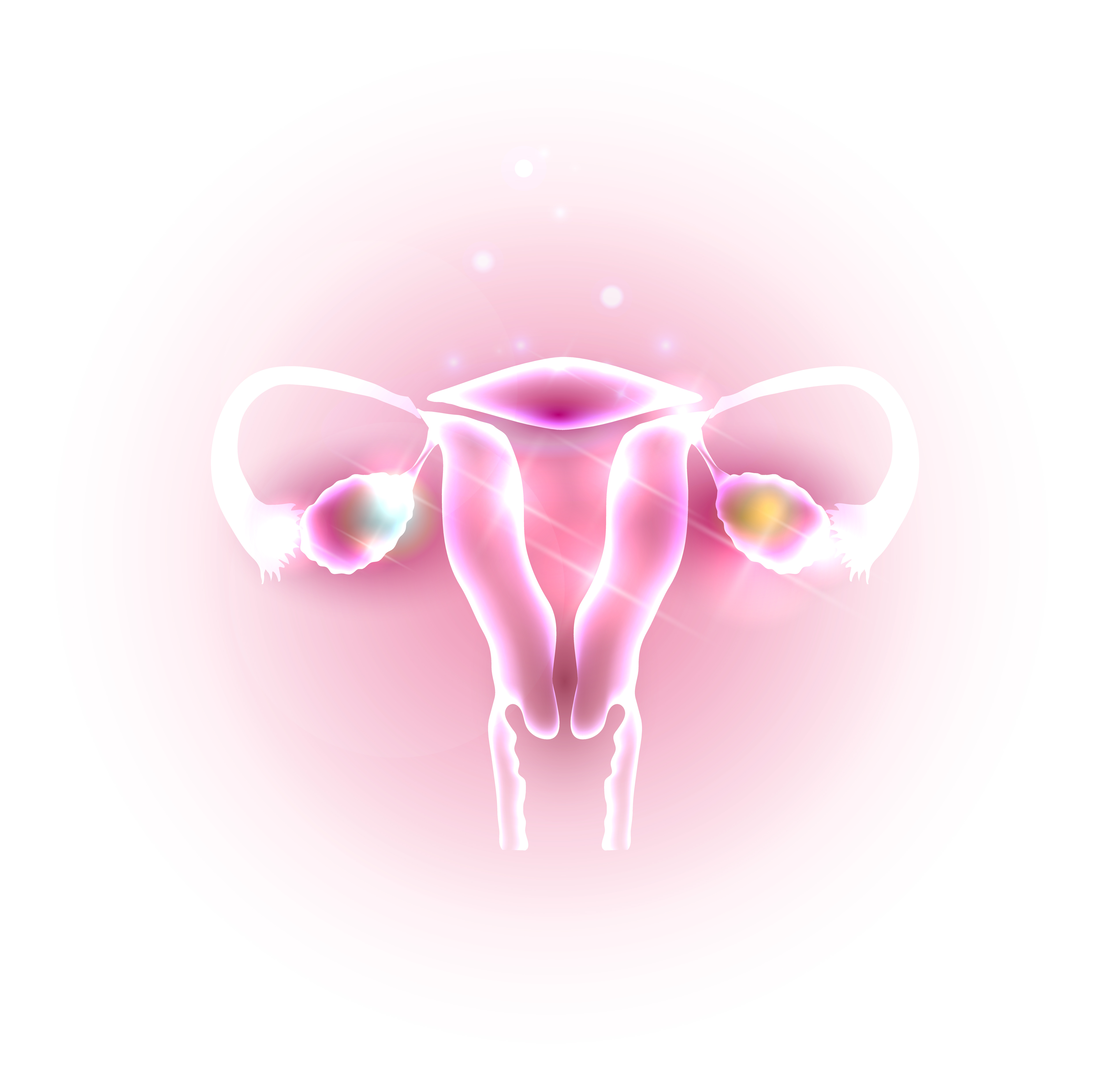 endometriosis 2