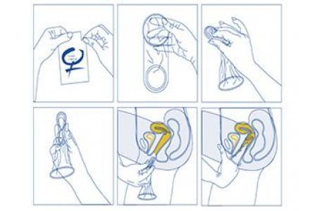 como ponerse un condon femenio