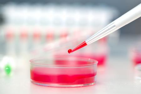 analisis de sangre