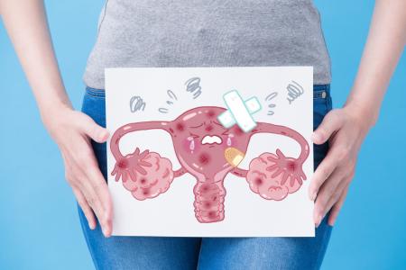 prolapso uterino