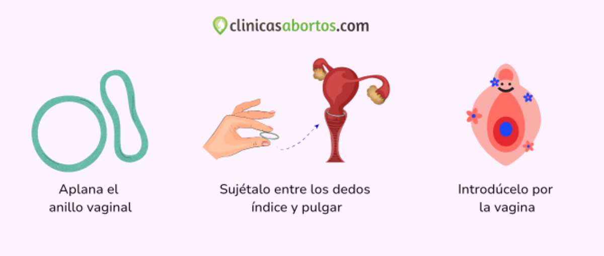 Poner el anillo vaginal