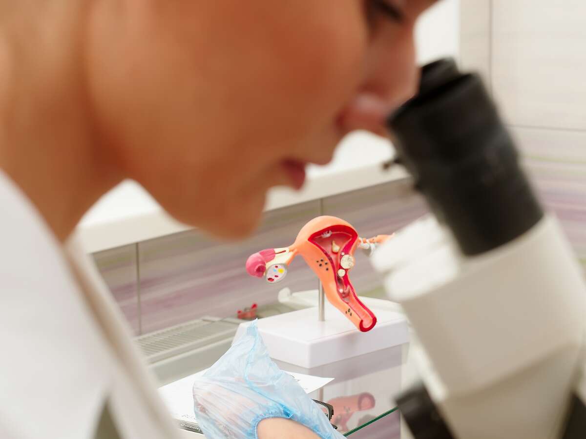 Colposcopia