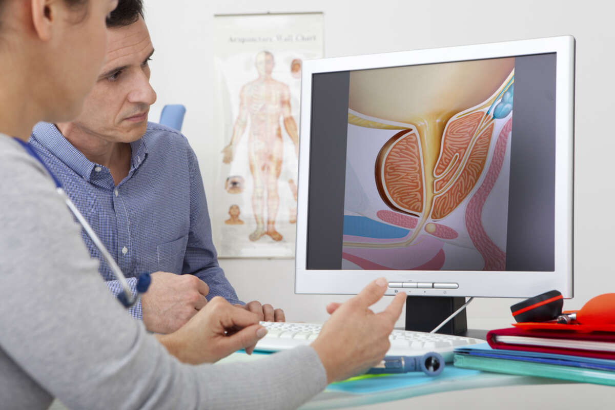 Enfermedades urologicas en el hombre