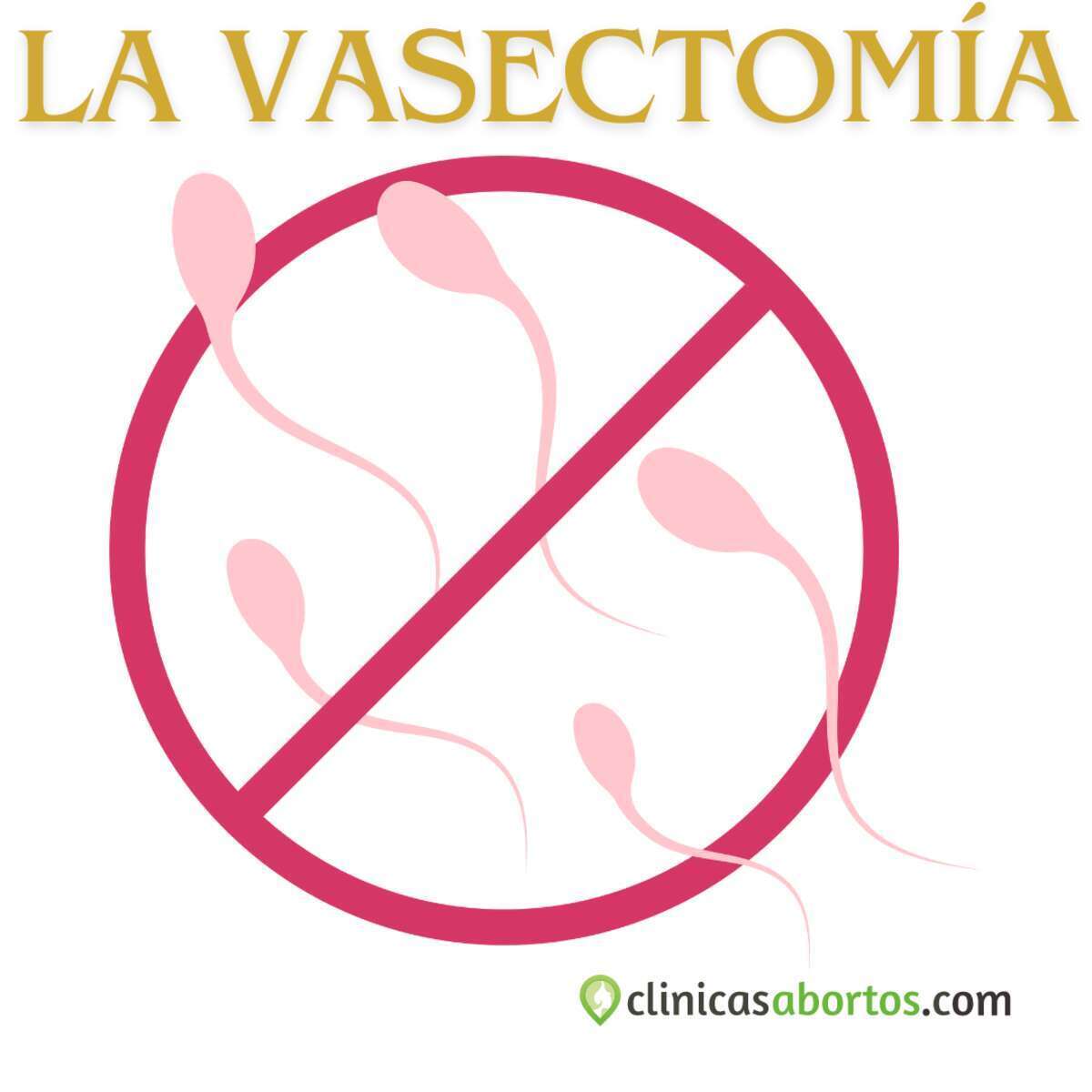 Vasectomia